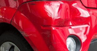 Car Dent Removal Cost