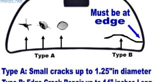 Windshield Crack Repair